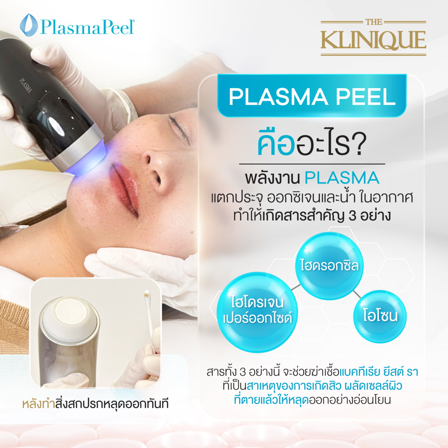 ลดสิวอุดตัน ทำความสะอาดผิวหมดจดด้วยนวัตกรรม Plasma Peel - Theklinique