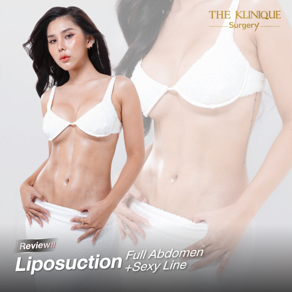 Liposuction, Sculpting,Xshape,Lipo, ศัลยกรรมดูดไขมัน, ดูดไขมัน,คลินิกดูดไขมัน,ดูดไขมันเฉพาะส่วน,ดูดไขมันเหนียง,ดูดไขมันหน้าท้อง,ดูดไขมันรีวิว, รีวิวดูดไขมัน, รีวิวดูดไขมันหน้าท้อง,ดูดไขมันต้นแขน, ดูดไขมันต้นขา,ดูดไขมันน่อง, ลดความอ้วน, ดูดไขมันที่ไหนดี, ดูดไขมันราคา, ดูดไขมันทั้งตัว