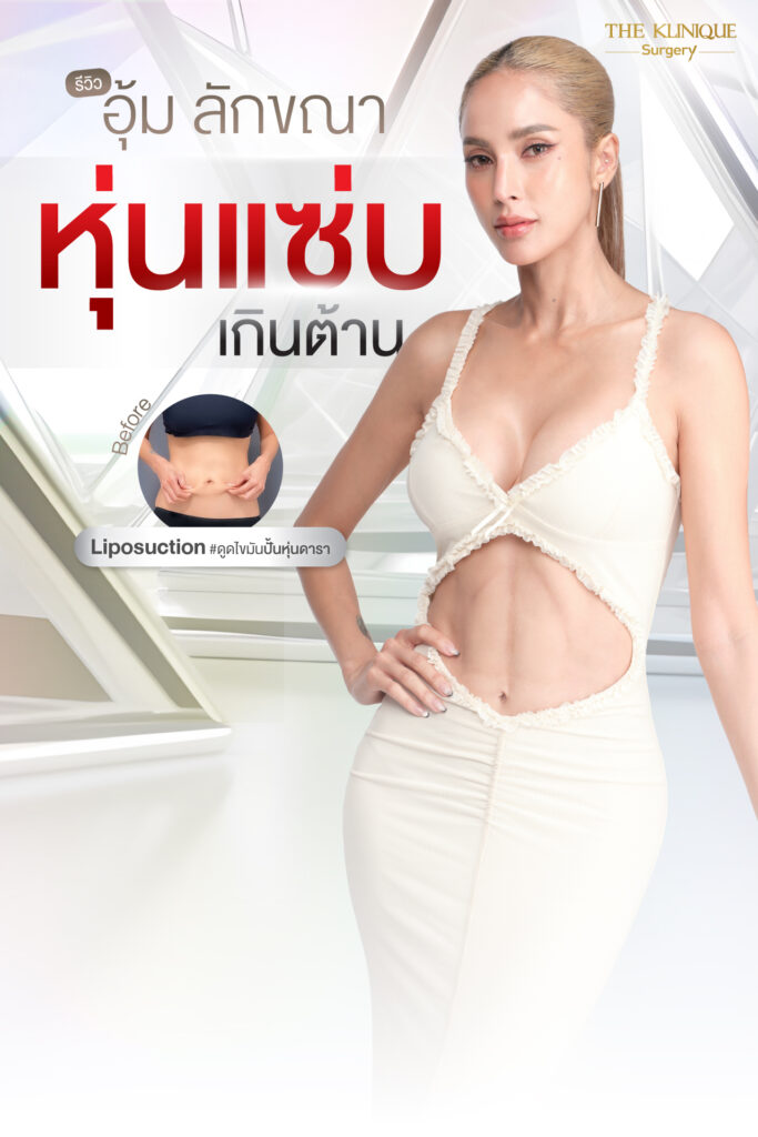  Liposuction, Sculpting,Xshape,Lipo, ศัลยกรรมดูดไขมัน, ดูดไขมัน,คลินิกดูดไขมัน,ดูดไขมันหน้าท้อง,รีวิวดูดไขมันหน้าท้อง,ดูดไขมันที่ไหนดี, ดูดไขมันราคา