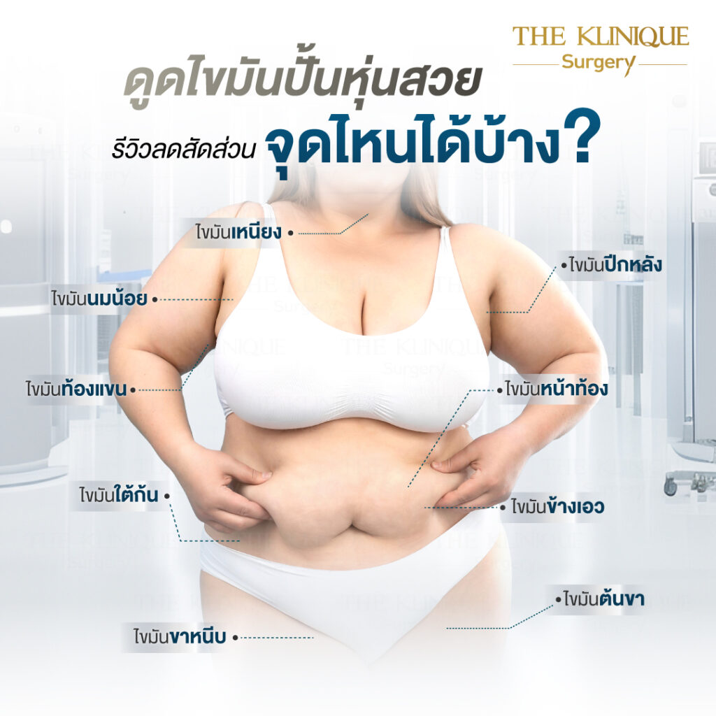 Liposuction, Sculpting,Xshape,Lipo, ศัลยกรรมดูดไขมัน, ดูดไขมัน,คลินิกดูดไขมัน,ดูดไขมันเฉพาะส่วน,ดูดไขมันเหนียง,ดูดไขมันหน้าท้อง,ดูดไขมันรีวิว, รีวิวดูดไขมัน, รีวิวดูดไขมันหน้าท้อง,ดูดไขมันต้นแขน, ดูดไขมันต้นขา,ดูดไขมันน่อง, ลดความอ้วน, ดูดไขมันที่ไหนดี, ดูดไขมันราคา, ดูดไขมันทั้งตัว