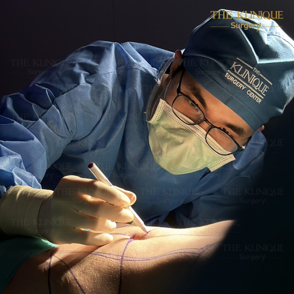 Liposuction, Sculpting,Xshape,Lipo, ศัลยกรรมดูดไขมัน, ดูดไขมัน,คลินิกดูดไขมัน,ดูดไขมันเฉพาะส่วน,ดูดไขมันเหนียง,ดูดไขมันหน้าท้อง,ดูดไขมันรีวิว, รีวิวดูดไขมัน, รีวิวดูดไขมันหน้าท้อง,ดูดไขมันต้นแขน, ดูดไขมันต้นขา,ดูดไขมันน่อง, ลดความอ้วน, ดูดไขมันที่ไหนดี, ดูดไขมันราคา, ดูดไขมันทั้งตัว