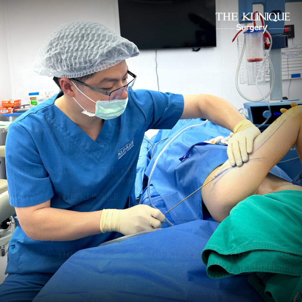 Liposuction, Sculpting,Xshape,Lipo, ศัลยกรรมดูดไขมัน, ดูดไขมัน,คลินิกดูดไขมัน,ดูดไขมันเฉพาะส่วน,ดูดไขมันเหนียง,ดูดไขมันหน้าท้อง,ดูดไขมันรีวิว, รีวิวดูดไขมัน, รีวิวดูดไขมันหน้าท้อง,ดูดไขมันต้นแขน, ดูดไขมันต้นขา,ดูดไขมันน่อง, ลดความอ้วน, ดูดไขมันที่ไหนดี, ดูดไขมันราคา, ดูดไขมันทั้งตัว