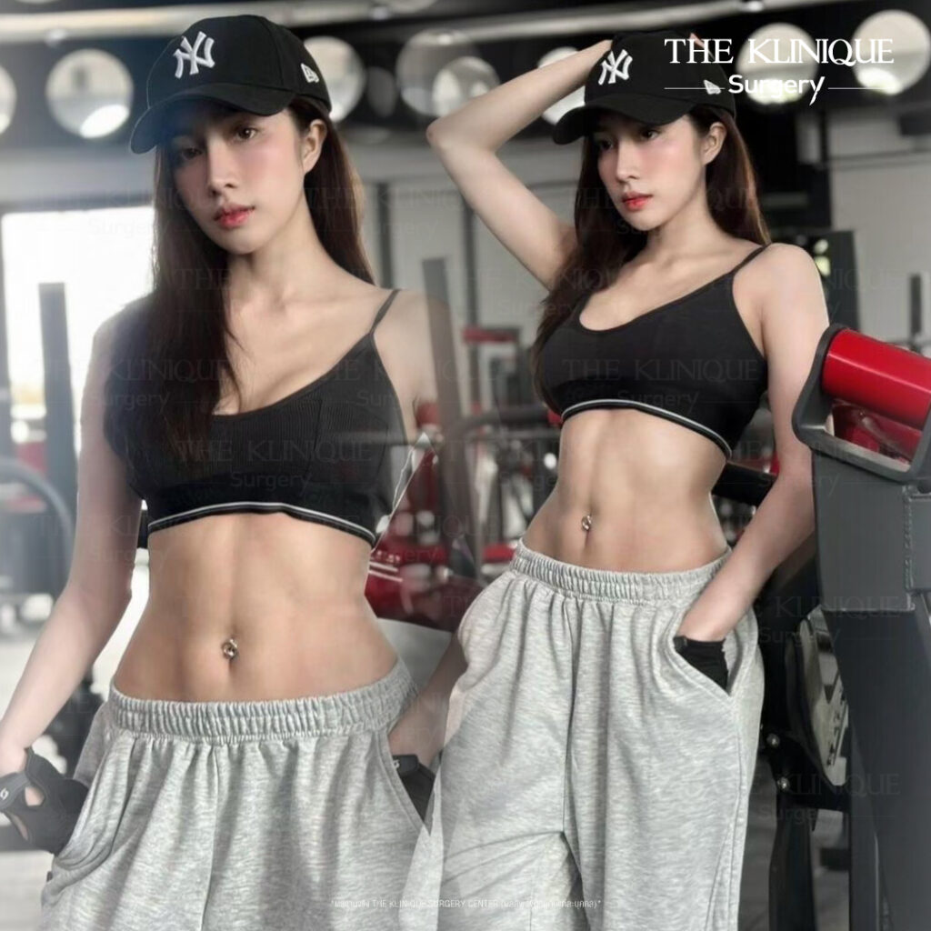 Liposuction, Sculpting,Xshape,Lipo, ศัลยกรรมดูดไขมัน, ดูดไขมัน,คลินิกดูดไขมัน,ดูดไขมันเฉพาะส่วน,ดูดไขมันเหนียง,ดูดไขมันหน้าท้อง,ดูดไขมันรีวิว, รีวิวดูดไขมัน, รีวิวดูดไขมันหน้าท้อง,ดูดไขมันต้นแขน, ดูดไขมันต้นขา,ดูดไขมันน่อง, ลดความอ้วน, ดูดไขมันที่ไหนดี, ดูดไขมันราคา, ดูดไขมันทั้งตัว