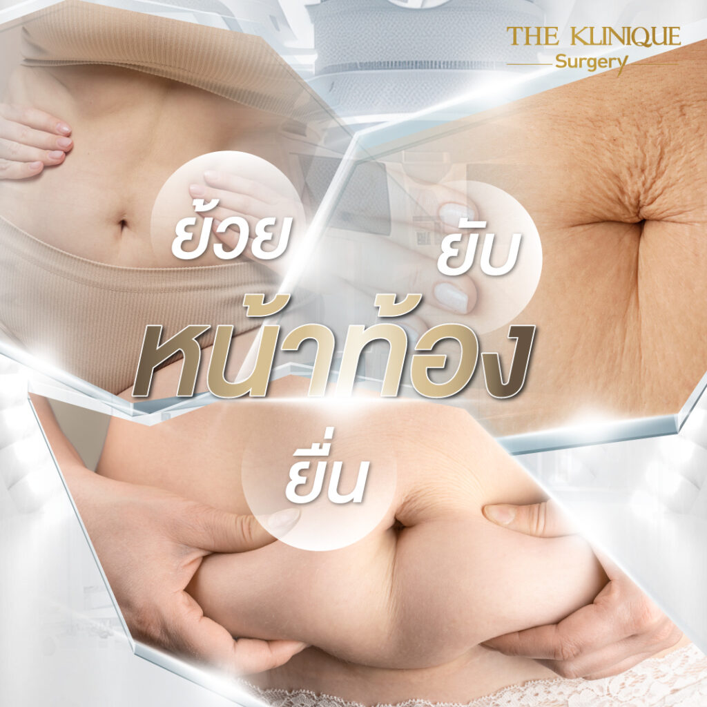 Liposuction, Sculpting,Xshape,Lipo, ศัลยกรรมดูดไขมัน, ดูดไขมัน,คลินิกดูดไขมัน,ดูดไขมันเฉพาะส่วน,ดูดไขมันเหนียง,ดูดไขมันหน้าท้อง,ดูดไขมันรีวิว, รีวิวดูดไขมัน, รีวิวดูดไขมันหน้าท้อง,ดูดไขมันต้นแขน, ดูดไขมันต้นขา,ดูดไขมันน่อง, ลดความอ้วน, ดูดไขมันที่ไหนดี, ดูดไขมันราคา, ดูดไขมันทั้งตัว