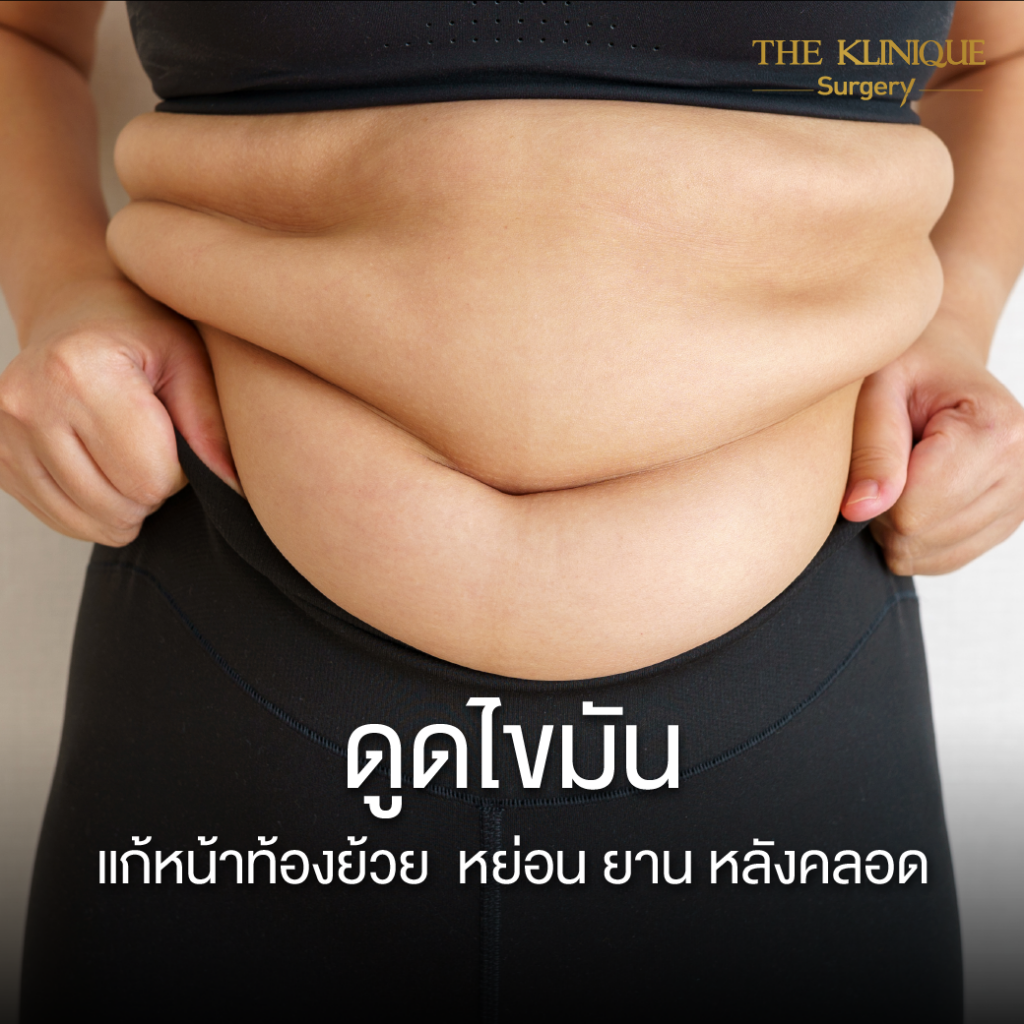 Liposuction, Sculpting,Xshape,Lipo, ศัลยกรรมดูดไขมัน, ดูดไขมัน,คลินิกดูดไขมัน,ดูดไขมันเฉพาะส่วน,ดูดไขมันเหนียง,ดูดไขมันหน้าท้อง,ดูดไขมันรีวิว, รีวิวดูดไขมัน, รีวิวดูดไขมันหน้าท้อง,ดูดไขมันต้นแขน, ดูดไขมันต้นขา,ดูดไขมันน่อง, ลดความอ้วน, ดูดไขมันที่ไหนดี, ดูดไขมันราคา, ดูดไขมันทั้งตัว