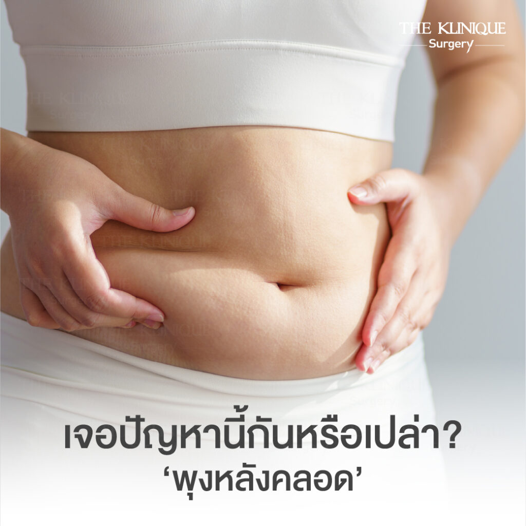 Liposuction, Sculpting,Xshape,Lipo, ศัลยกรรมดูดไขมัน, ดูดไขมัน,คลินิกดูดไขมัน,ดูดไขมันเฉพาะส่วน,ดูดไขมันเหนียง,ดูดไขมันหน้าท้อง,ดูดไขมันรีวิว, รีวิวดูดไขมัน, รีวิวดูดไขมันหน้าท้อง,ดูดไขมันต้นแขน, ดูดไขมันต้นขา,ดูดไขมันน่อง, ลดความอ้วน, ดูดไขมันที่ไหนดี, ดูดไขมันราคา, ดูดไขมันทั้งตัว