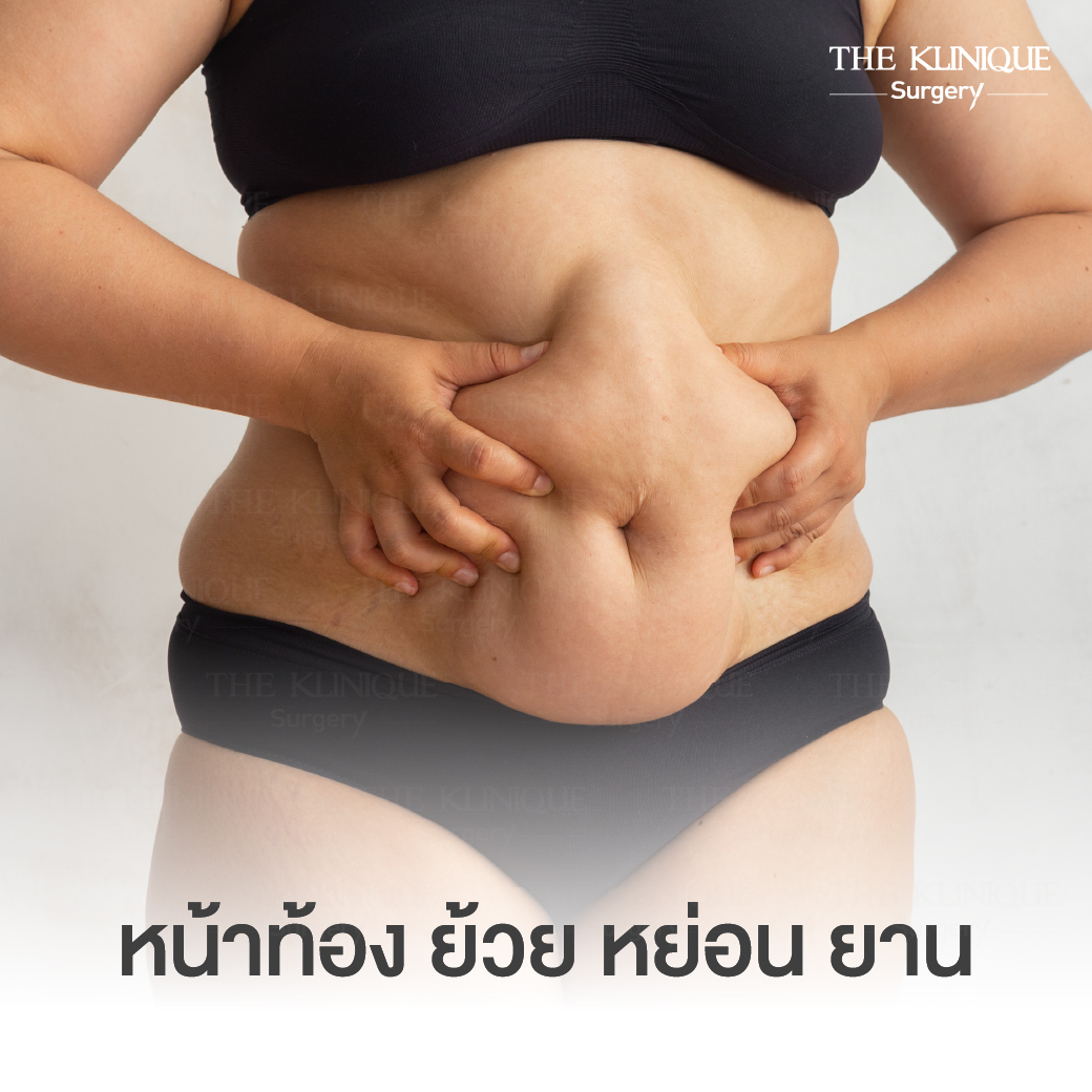 Liposuction, Sculpting,Xshape,Lipo, ศัลยกรรมดูดไขมัน, ดูดไขมัน,คลินิกดูดไขมัน,ดูดไขมันเฉพาะส่วน,ดูดไขมันเหนียง,ดูดไขมันหน้าท้อง,ดูดไขมันรีวิว, รีวิวดูดไขมัน, รีวิวดูดไขมันหน้าท้อง,ดูดไขมันต้นแขน, ดูดไขมันต้นขา,ดูดไขมันน่อง, ลดความอ้วน, ดูดไขมันที่ไหนดี, ดูดไขมันราคา, ดูดไขมันทั้งตัว