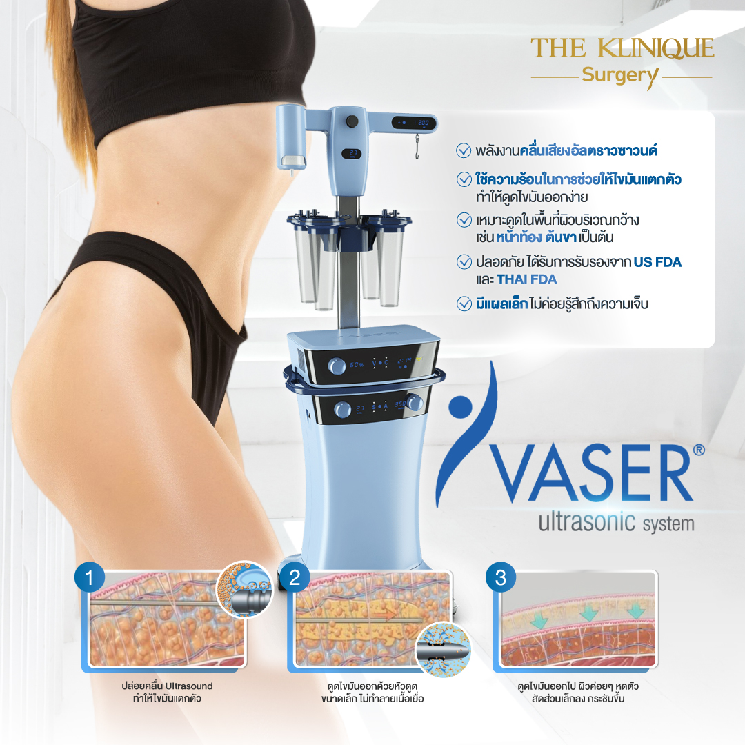 Liposuction, Sculpting,Xshape,Lipo, ศัลยกรรมดูดไขมัน, ดูดไขมัน,คลินิกดูดไขมัน,ดูดไขมันเฉพาะส่วน,ดูดไขมันเหนียง,ดูดไขมันหน้าท้อง,ดูดไขมันรีวิว, รีวิวดูดไขมัน, รีวิวดูดไขมันหน้าท้อง,ดูดไขมันต้นแขน, ดูดไขมันต้นขา,ดูดไขมันน่อง, ลดความอ้วน, ดูดไขมันที่ไหนดี, ดูดไขมันราคา, ดูดไขมันทั้งตัว, รีวิว ดูดไขมันต้นขา, ดูดไขมันขา